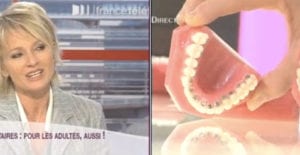 orthodontie adulte sur France2