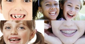 l'orthodontie chez l'enfant