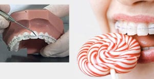 appareil cassé ou décollé