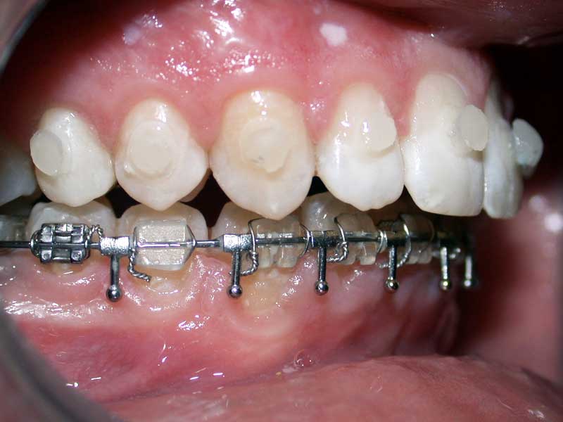 Boutons Pour Chirurgie profil Boutons Pour Chirurgie profil