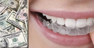 tarif traitement orthodontique