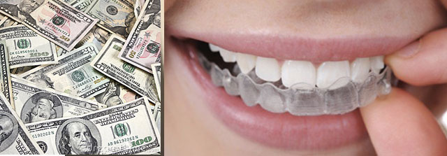 tarif traitement orthodontique
