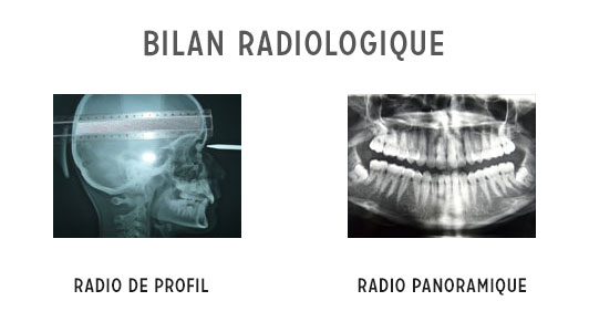 bilan orthodontique