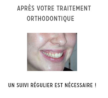 suivi après traitement orthodontique