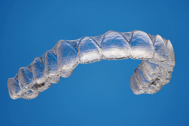 Appareil Invisalign