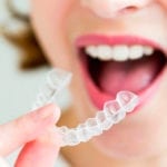 appareil Invisalign
