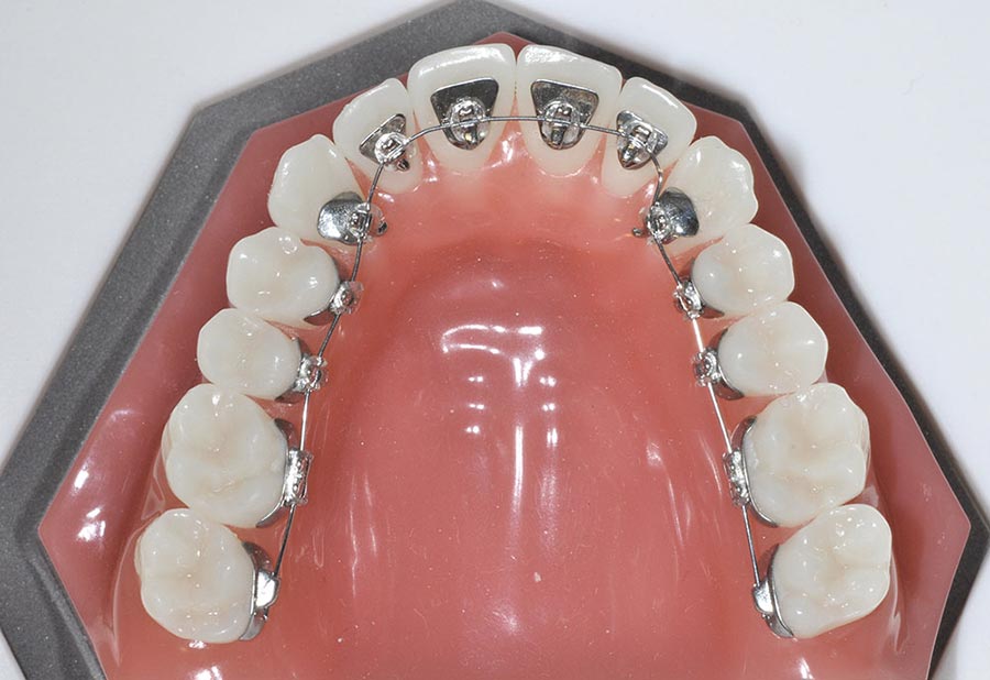 L'orthodontie n'est pas réservée aux enfants : 5 raisons pour lesquelles  les adultes se lancent dans un traitement (explications et conseils du Dr  Issembert)