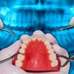 orthodontie et chirurgie