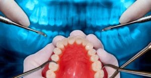 orthodontie etchirurgie