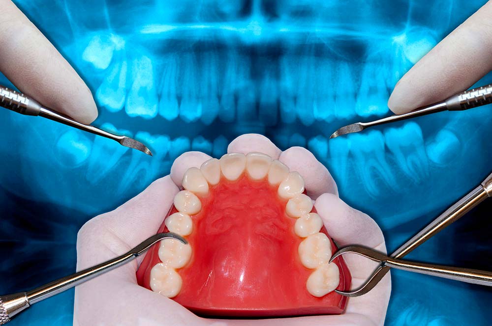 orthodontie etchirurgie