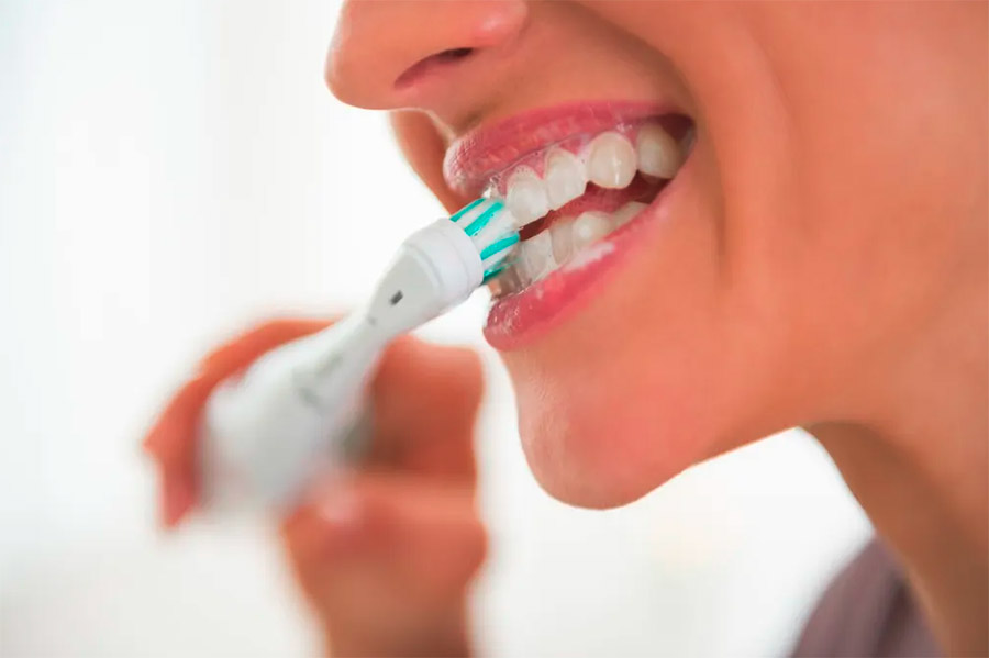 brossage de dents et traitement Invisalign