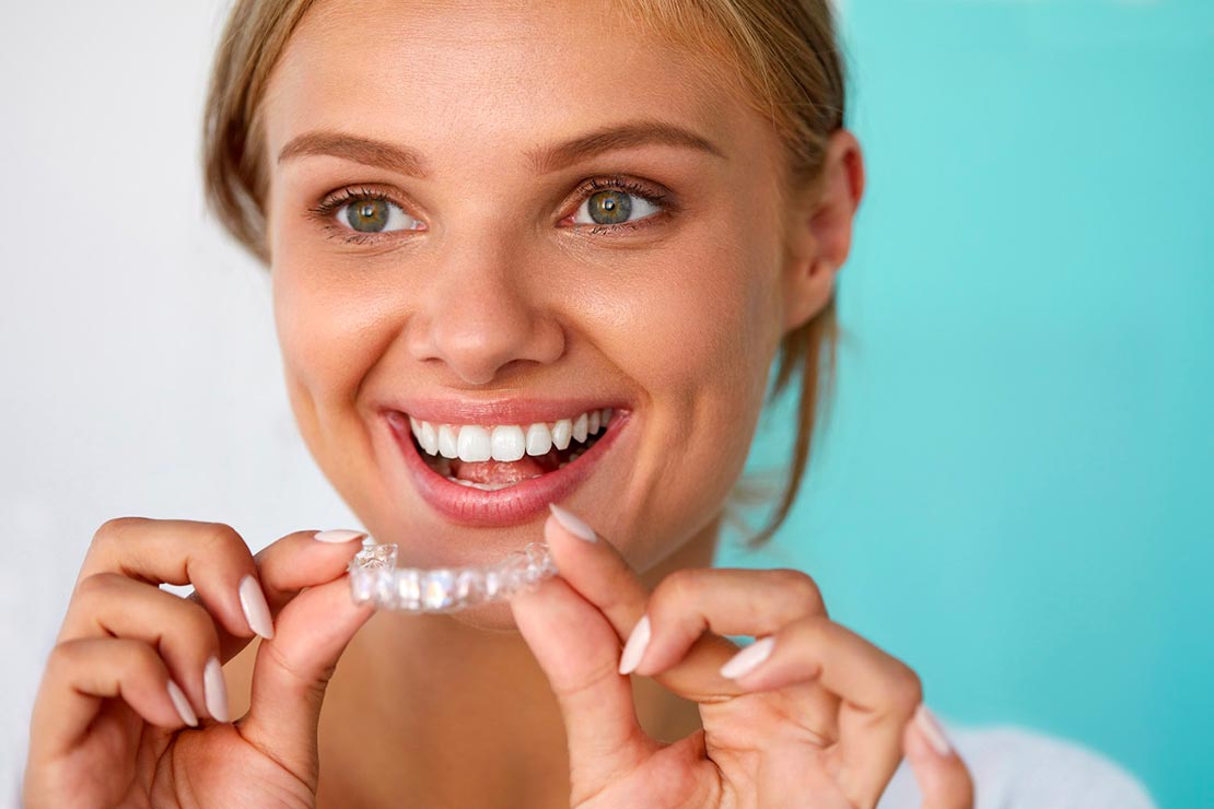 Invisalign gouttière quasi invisible