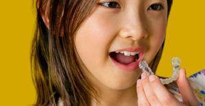 Invisalign Teen pour les enfants