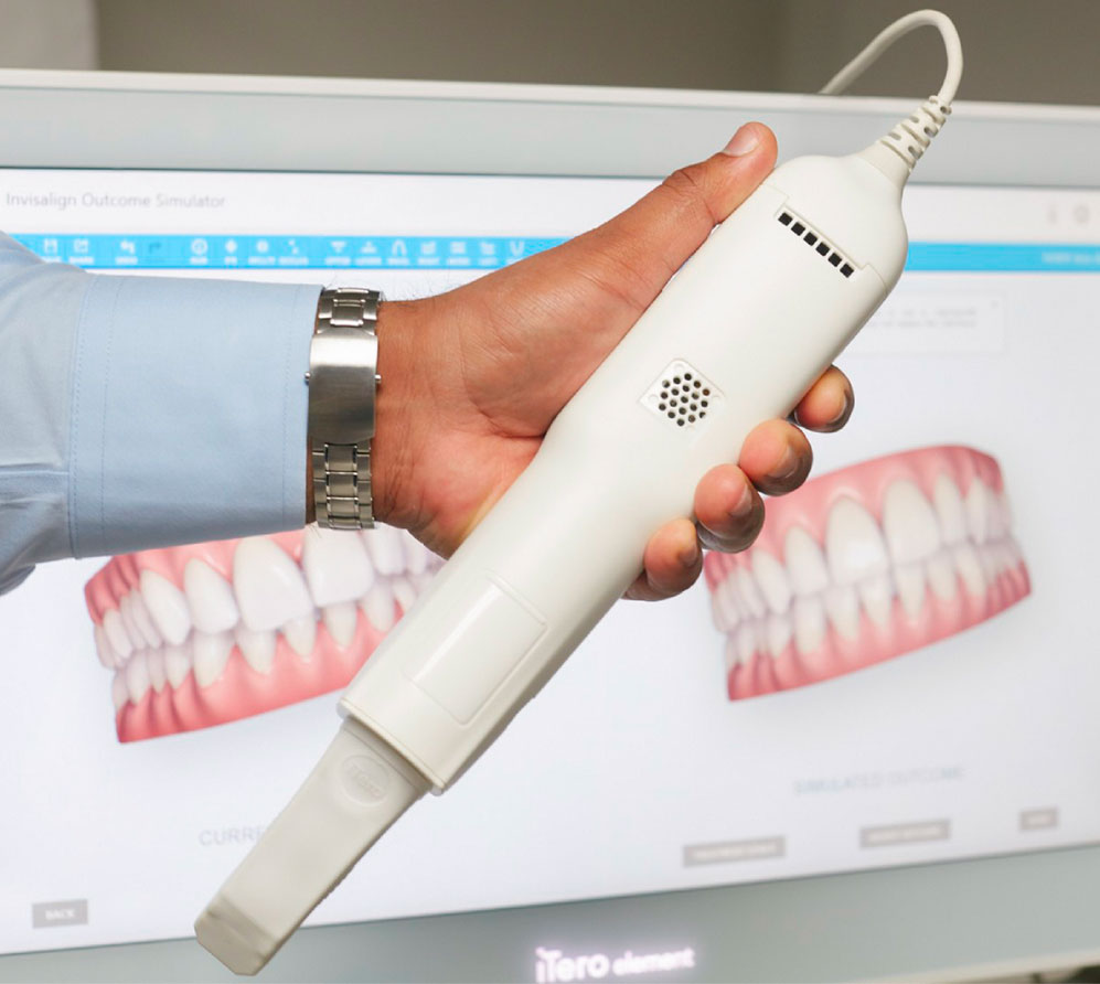 Scanner 3D iTero pour réaliser des empreintes dentaires