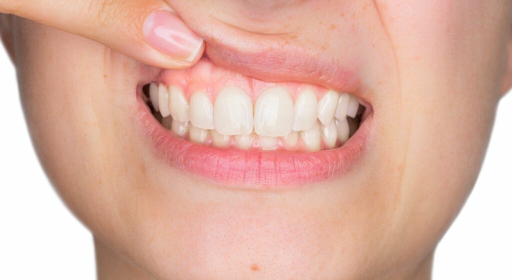 meilleur orthodontiste Paris orthodontie adulte Paris Invisalign Paris appareil dentaire Paris orthodontiste réputé Paris traitement orthodontique