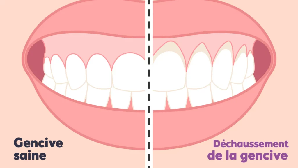 meilleur orthodontiste Paris orthodontie adulte Paris Invisalign Paris appareil dentaire Paris orthodontiste réputé Paris traitement orthodontique